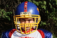 Mouth Guards